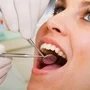 Dental Fillings Inlays Onlays Services In South Africa