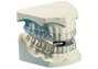 Mandibular Advancement Appliance Dentist South Africa